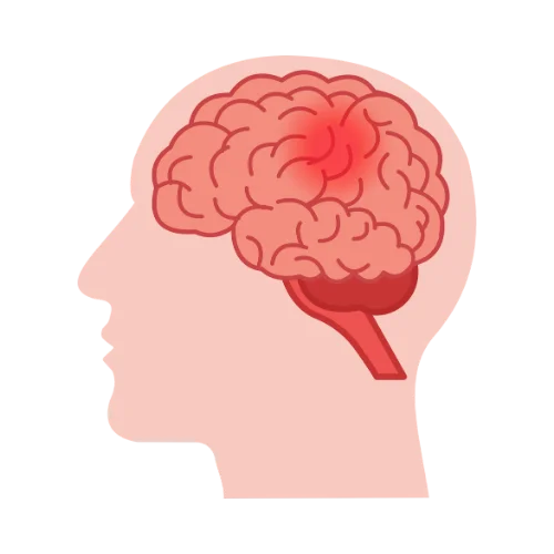 Brain injury rehabilitation illustration