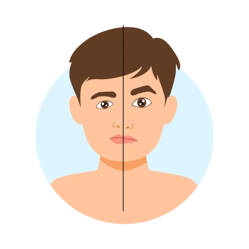 Stroke rehabilitation illustration