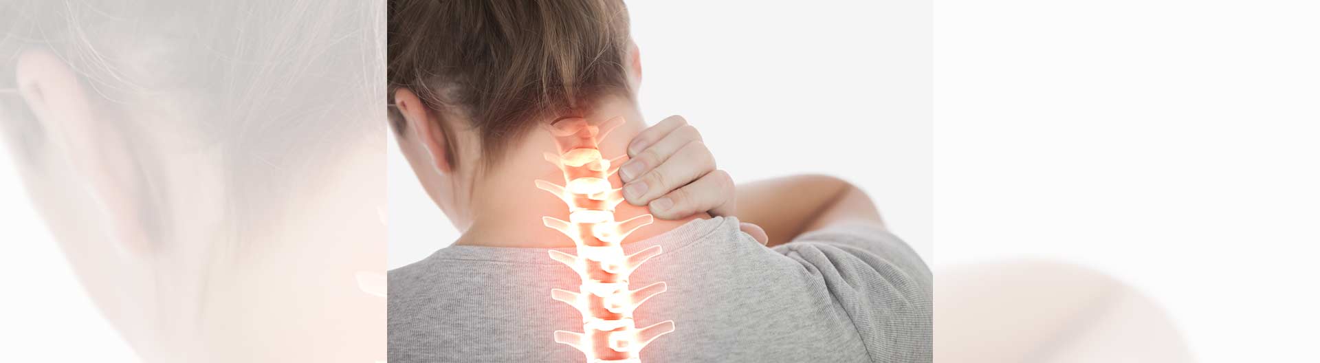 Cervical Spondylosis