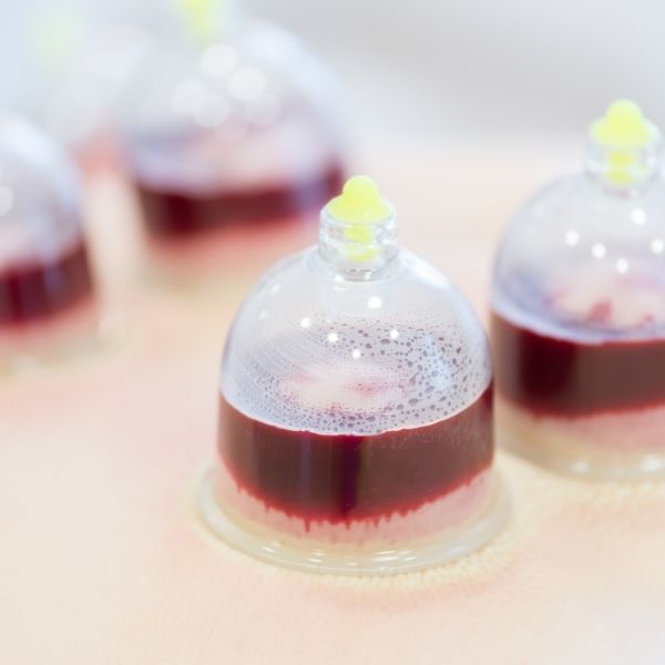 Blood (wet) cupping treatment in Mumbai