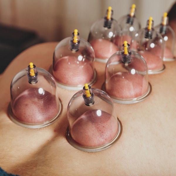 Hijama cupping treatment in Mumbai