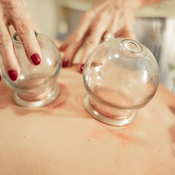 Suction cup therapy in Mumbai