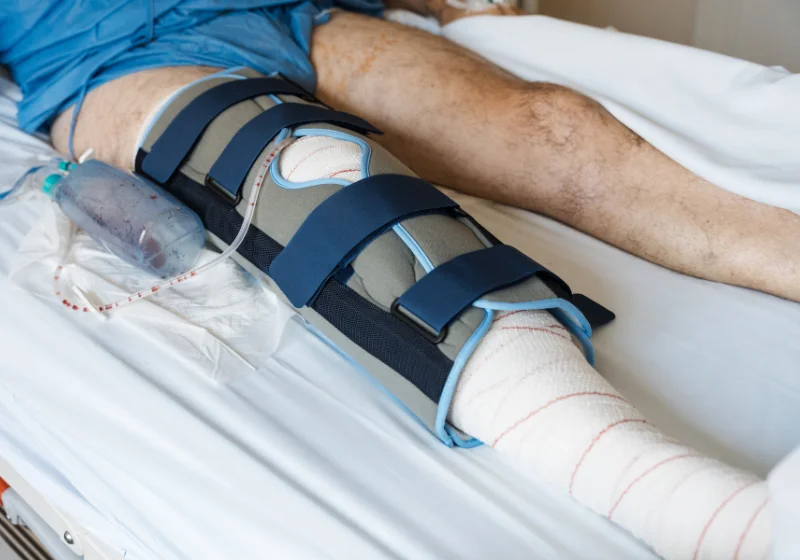 Patient in a post-operative knee brace progressing home rehabilitation exercises